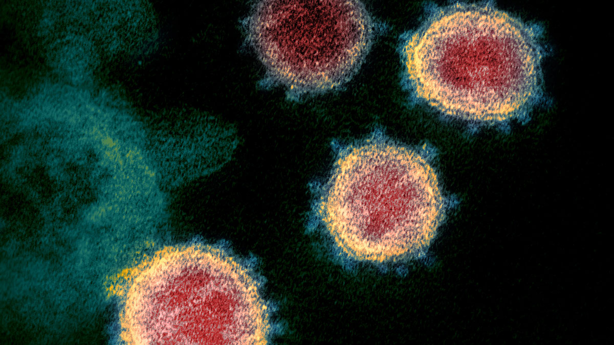Elektromikroskopische Aufnahme von SARS-CoV-2-Viren eines Patienten in den USA. Foto: NIAID Integrated Research Facility (IRF), Fort Detrick, Maryland (USA) / Wikipedia (https://de.wikipedia.org/wiki/Datei:Novel_Coronavirus_SARS-CoV-2_(cropped).jpg ) /Flickr (https://www.flickr.com/photos/niaid/49534865371/ )