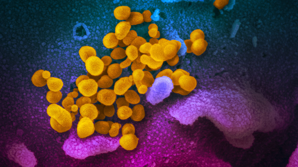 Elektro-Mikroskopische Aufnahme des Coronavirus SARS-CoV-2 (gelb), umgeben von weitere Zellen (blau und pink).Foto: NIAID Integrated Research Facility (IRF), Fort Detrick, Maryland (USA) / Wikipedia (https://de.wikipedia.org/wiki/Datei:SARS-CoV-2_(yellow).jpg ) /Flickr (https://www.flickr.com/photos/niaid/49531042877 )