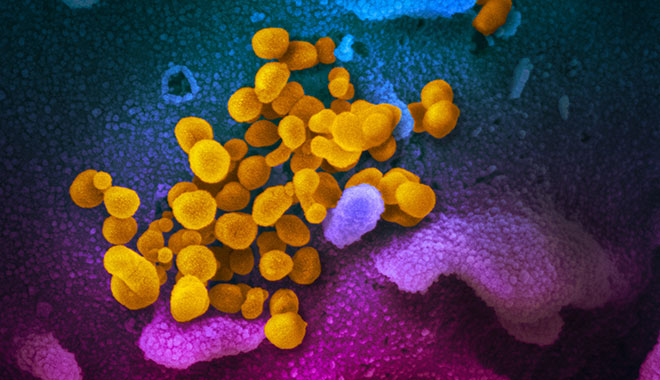 Elektro-Mikroskopische Aufnahme des Coronavirus SARS-CoV-2 (gelb), umgeben von weitere Zellen (blau und pink).Foto: NIAID Integrated Research Facility (IRF), Fort Detrick, Maryland (USA) / Wikipedia (https://de.wikipedia.org/wiki/Datei:SARS-CoV-2_(yellow).jpg ) /Flickr (https://www.flickr.com/photos/niaid/49531042877 )